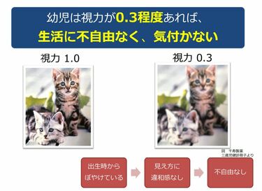 子どもの弱視見逃し｣は