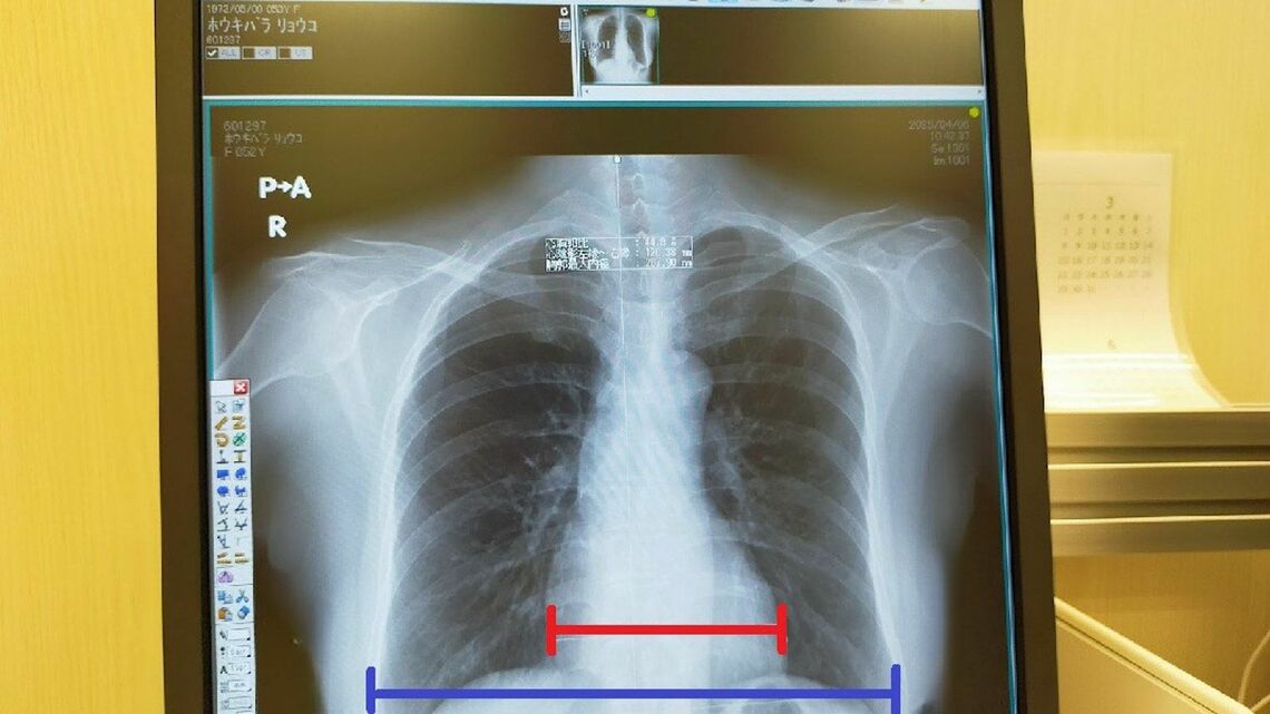 サントリーとキリンが“水”の奪い合い、ウイスキー製造で深刻な水不足問題