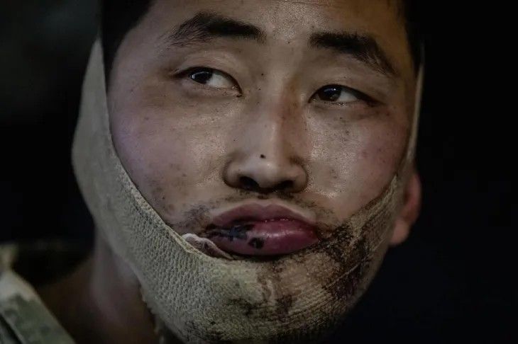 狙撃兵だという北朝鮮軍兵士捕虜（写真・ゼレンスキー大統領のTelegram）