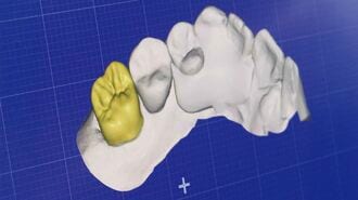 口腔の3Dデータ