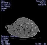 石灰化したイルカの腎臓のCT画像。白い部分が石灰化した場所（画像：西山氏提供）