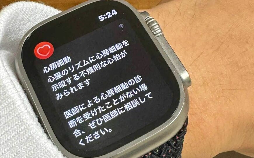 Apple Watchの表示