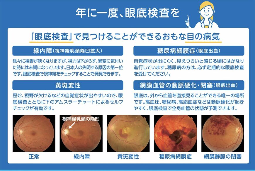眼底検査で見つけられる主な目の病気