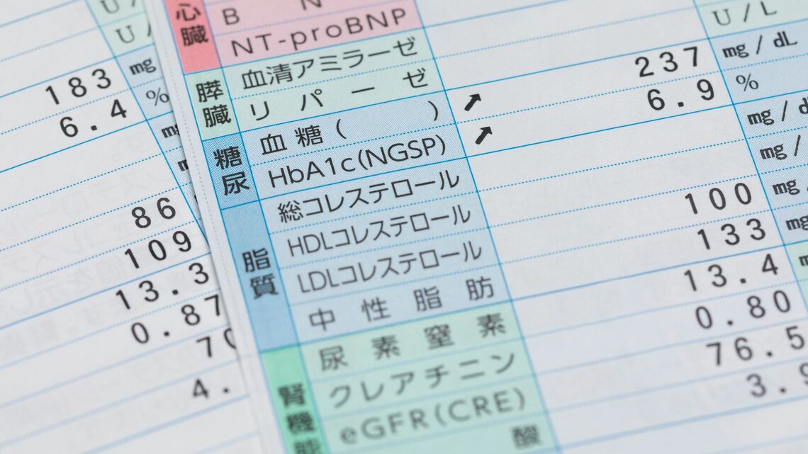 健診で「異常あり」と判定される人が年々増えているようです（写真：rogue／PIXTA）