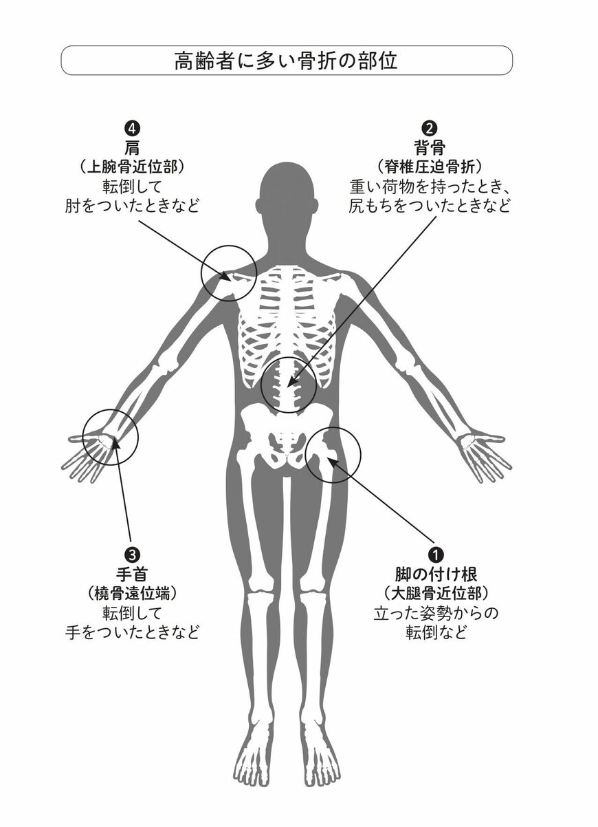 （出所）『栄養整形外科医の 一生折れない骨をつくる「強骨みそ汁」』より