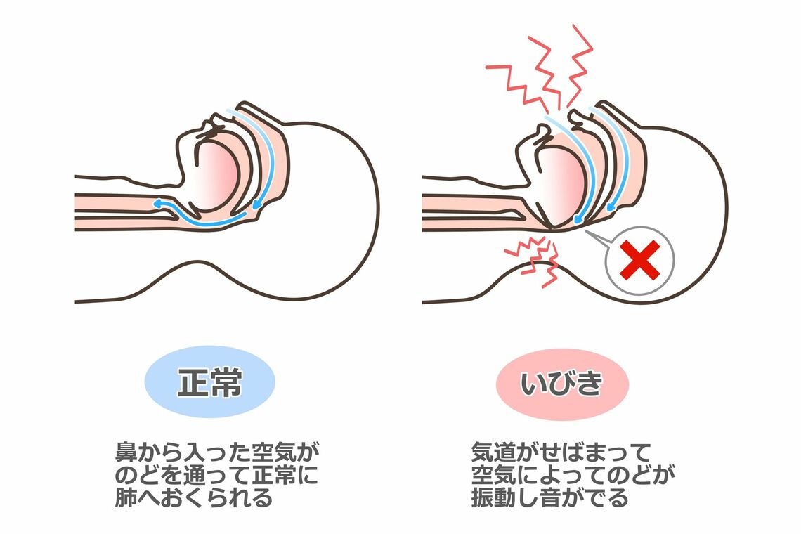 いびきの仕組み（イラスト：K.Nakano／PIXTA）