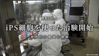 iPS細胞を使った治験開始 実用化の展望と課題