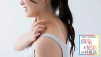 【帯状疱疹】子育て世代で急増する意外な背景 発症した部位によっては合併症､早期治療が鍵