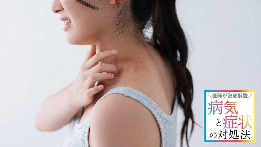 子育て世代で急増している帯状疱疹。背景にはなにがあるのでしょうか（写真：Ushico ／PIXTA）