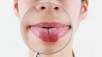 体調が丸わかり"危険な舌"の状態はこれだ 舌は｢健康のバロメーター｣
