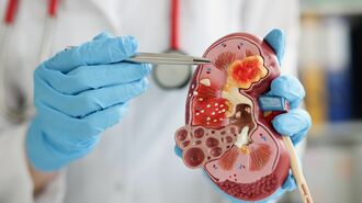 医師指南｢ここまで変わった｣腎臓復活の新常識