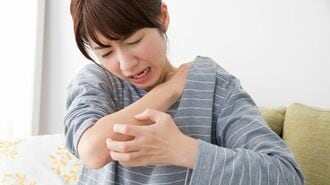 繰り返すかゆみ｢大人の蕁麻疹｣8割がこのタイプ