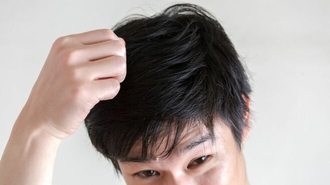 男性の薄毛は｢5タイプ｣知ると役立つ"髪の知識"