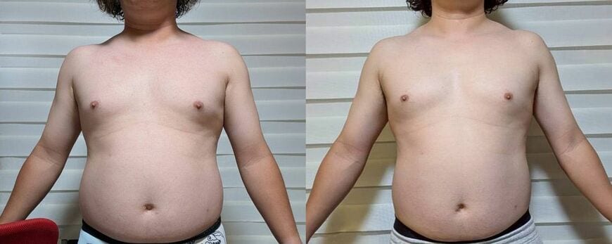 左がビフォー、右がアフター（写真：筆者の妻）