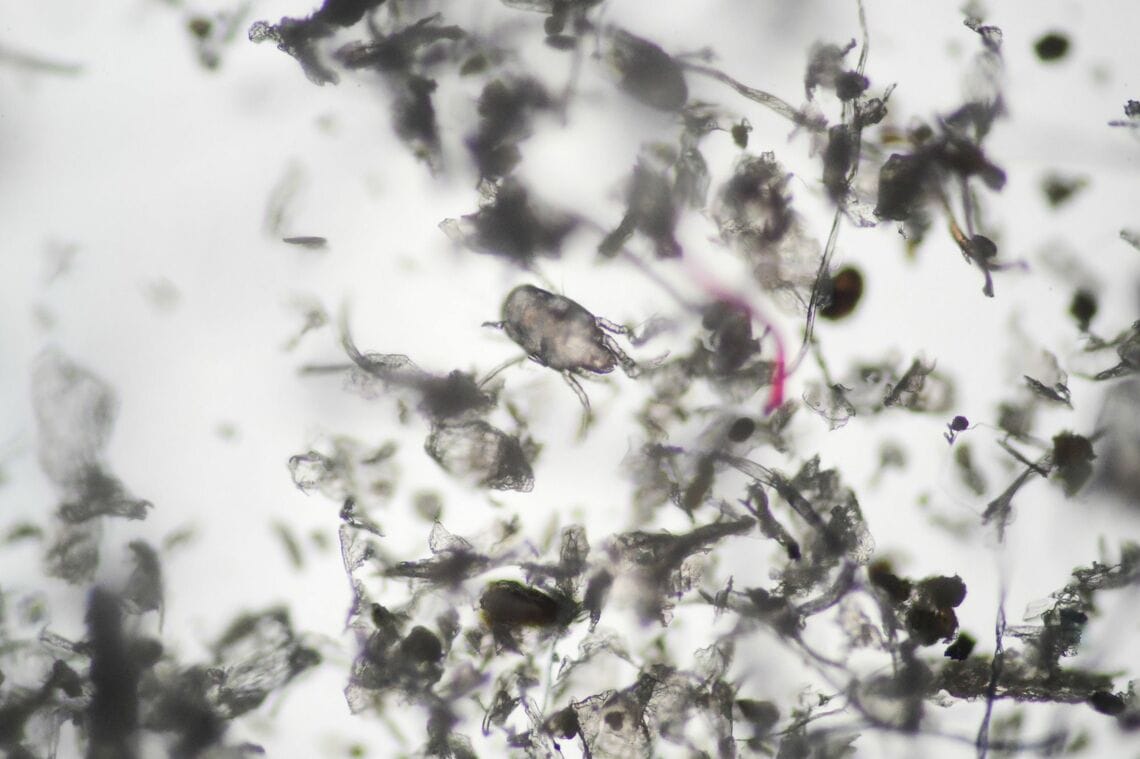 顕微鏡で拡大したダニとハウスダスト（写真：buru／PIXTA）