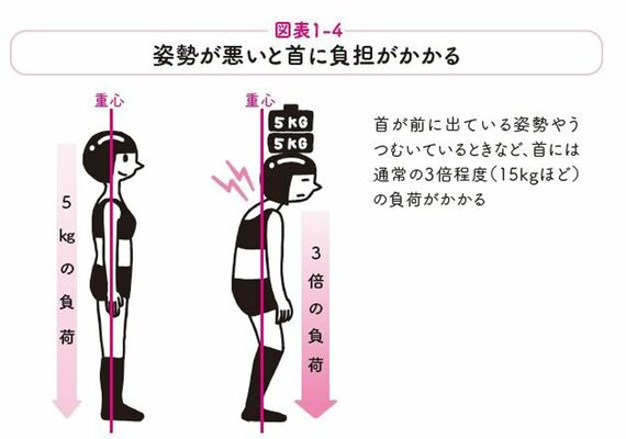 図 姿勢が悪いと首に負担がかかる