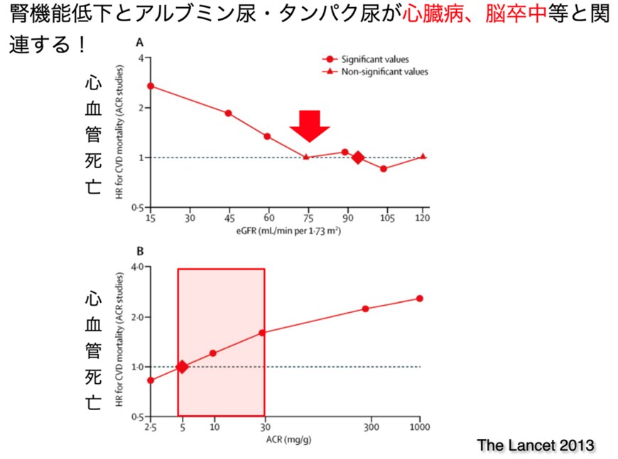 腎機能が低下すると心臓病、脳卒中のリスクが上がる（出所：Lancet Volume 382,  2013, Pages 339-352）